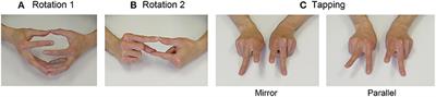 Performance of Bimanual Finger Coordination Tasks in Speakers Who Stutter